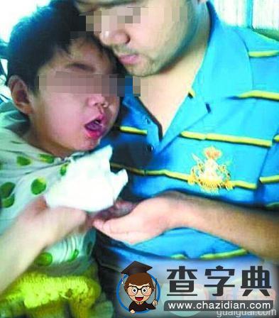 6月婴儿喝羊奶粉上吐下泻，被确诊为巨幼细胞性贫血2